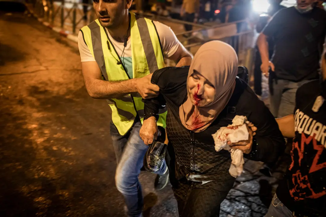 08 May 2021, Israel, Jerusalem: An injured woman is being helped during a demonstration against the planned eviction process for the Palestinians in the Sheikh Jarrah neighbourhood. Photo: Ilia Yefimovich/dpa