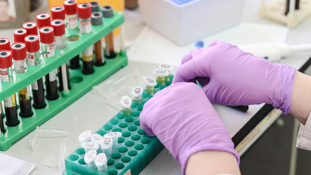 Laboratory-blood-test-samples