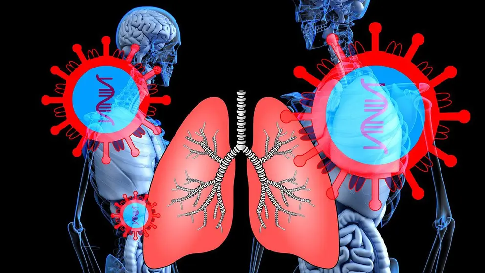 Coronavirus-lungs-skeleton-infection-flu-disease