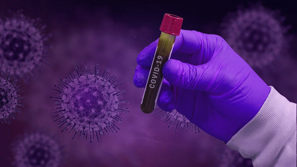 Coronavirus-Covid-19-test-laboratory-sample