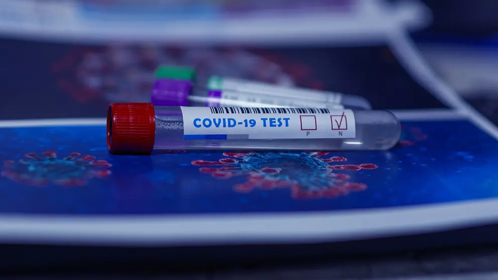 Covid-19-test-coronavirus