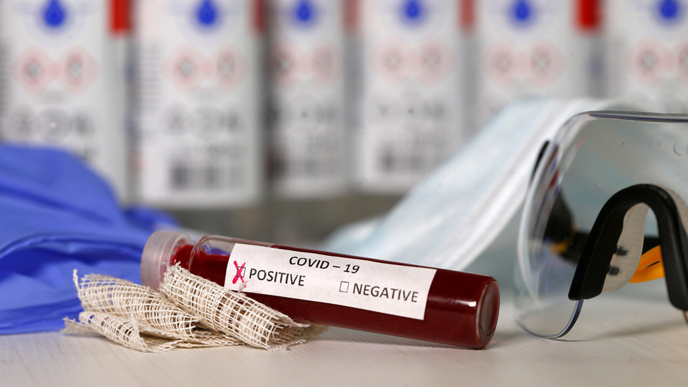 Fake blood is seen in test tubes labelled with the coronavirus (COVID-19) in this illustration taken March 17, 2020. REUTERS/Dado Ruvic/Illustration