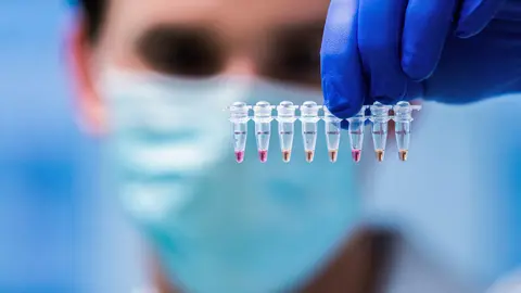 21 October 2020, Austria, Vienna: A laboratory employee examines coronavirus positive samples as part of the "LAMP" test procedure, a procedure that was developed in collaboration with the Vienna Research Institute and the Austrian Food Safety Agency (AGES). Photo: Georg Hochmuth/dpa.