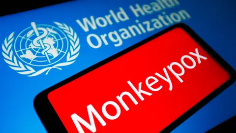 21 May 2022, Ukraine, ---: Monkeypox word is seen on the screen of a smartphone and the World Health Organization (WHO) logo in the background. Authorities in Australia, France and Germany confirmed their first cases of monkeypox on Friday as the normally rare disease continues to crop up in a growing number of countries around the globe. Photo: Pavlo Gonchar/SOPA Images via ZUMA Press Wire/dpa.