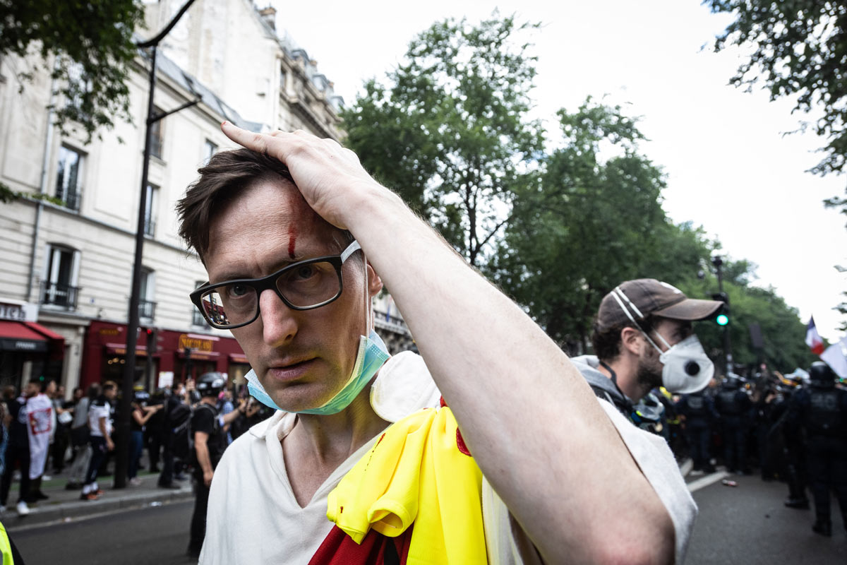 31 July 2021, France, Paris: An injured protestor is seen during a demonstration held against stricter coronavirus rules introduced by the French government as case numbers soared. Photo: Sadak Souici/Le Pictorium Agency via ZUMA/dpa