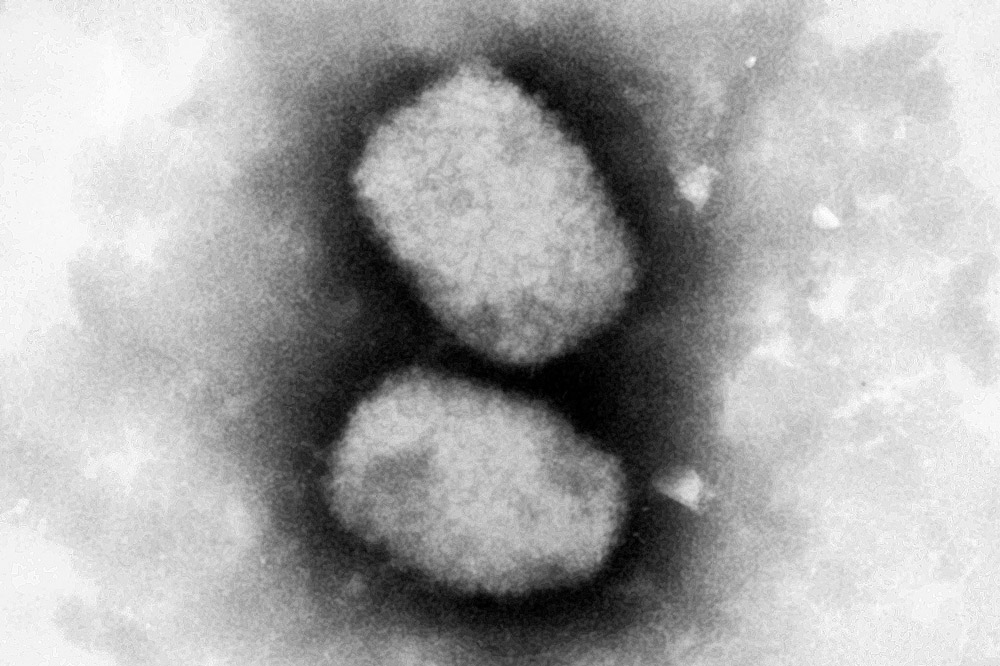 HANDOUT - 29 June 2001, Berlin: An electron micrograph provided by the Robert Koch Institute (RKI) shows the monkeypox virus. A case of monkeypox has been detected in Germany for the first time, according to the Army Medical Service. Photo: Andrea Männel/RKI/dpa - ATTENTION: editorial use only and only if the credit mentioned above is referenced in full.